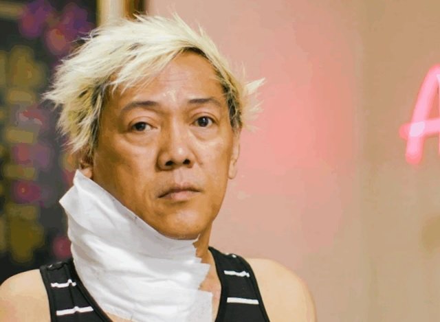 Ate Gay, nakitaan uli ng bukol sa leeg, naagapan