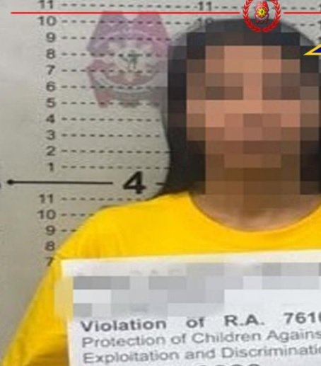 Stepson kinagat ng madrasta