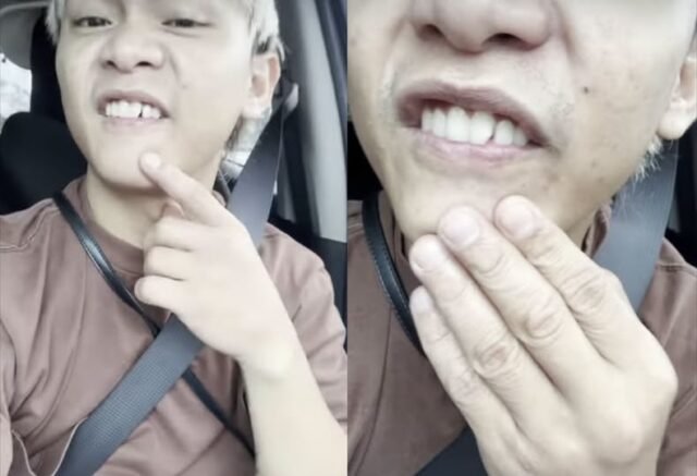 Buboy, napuruhan ang ngipin sa turon